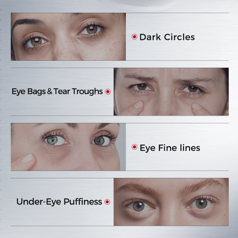 Koyu Halkalar için Göz Bantlar - Sheet Mask Collagen incelemesi ve fiyatı